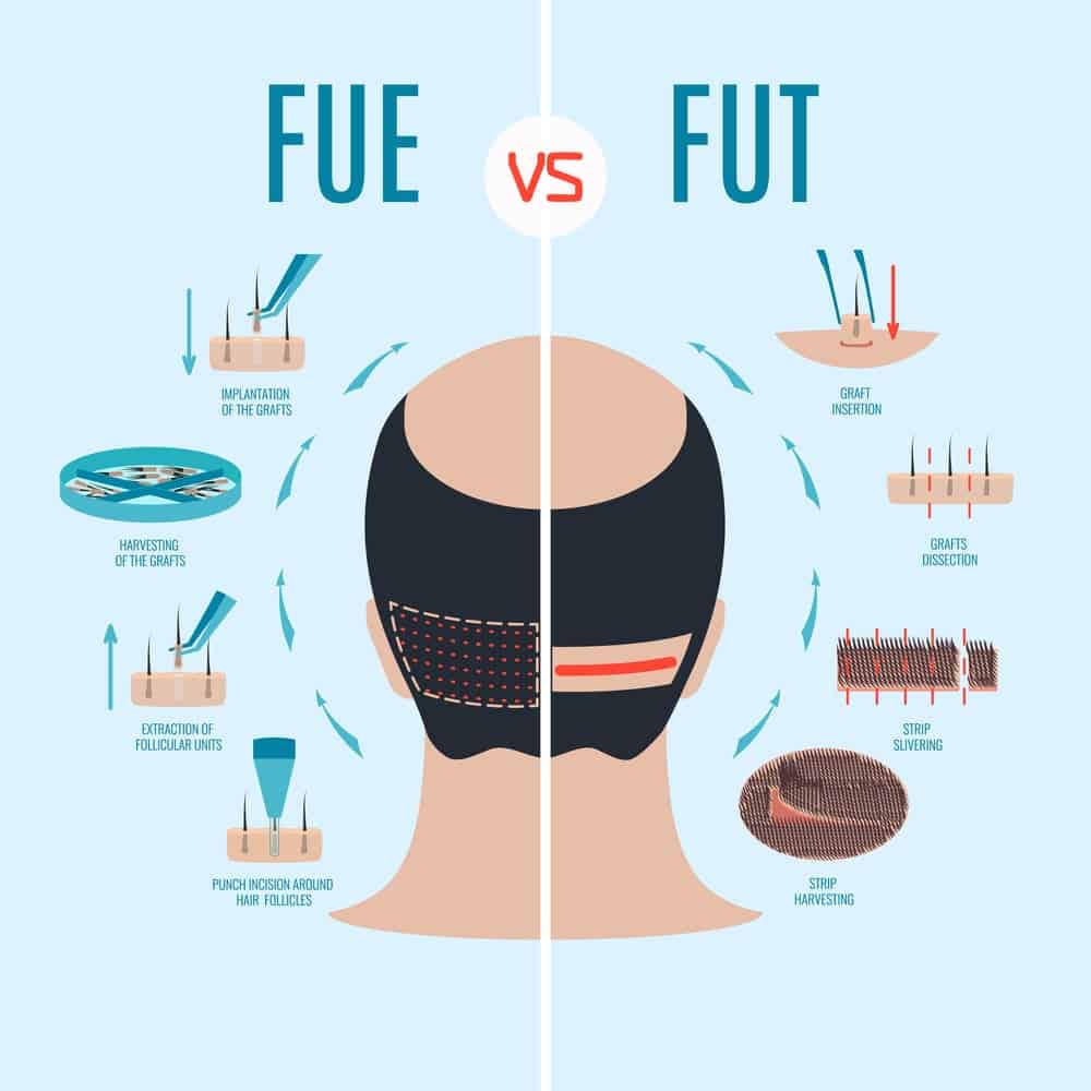 fue vs fut image